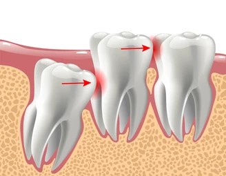 Best Dental & Orthodontic Clinic @ Banani & Gulshan, Dhaka