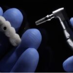 Dental Implant