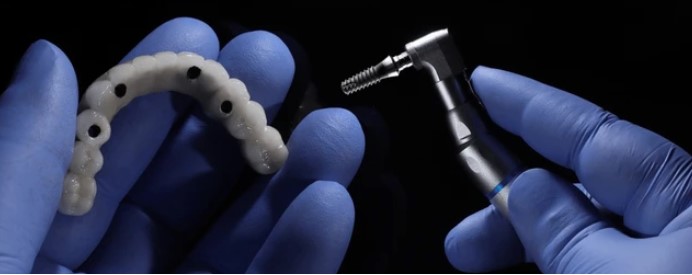 Dental Implant
