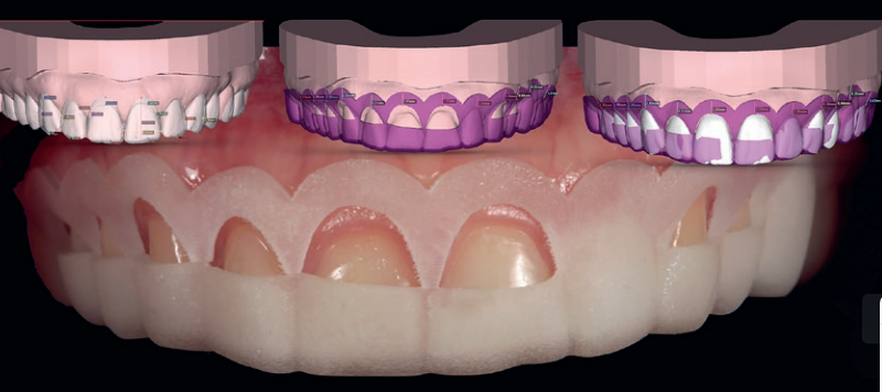 digital smile design