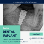 Dental Implants in Dhaka