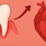 Gum disease and heart disease