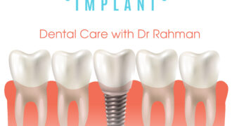 Cost of Dental Implant in Bangladesh