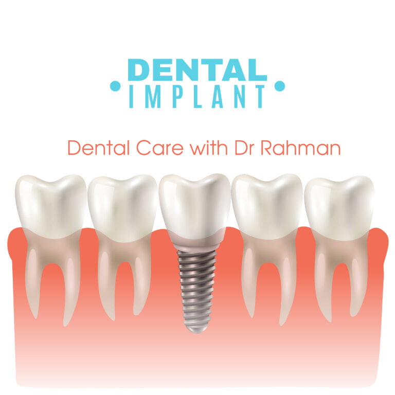 Cost of Dental Implant in Bangladesh