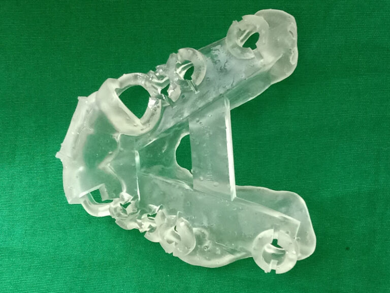 3 D Surgical Guide for dental Implant