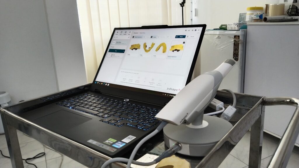 trios 3d dental scanner