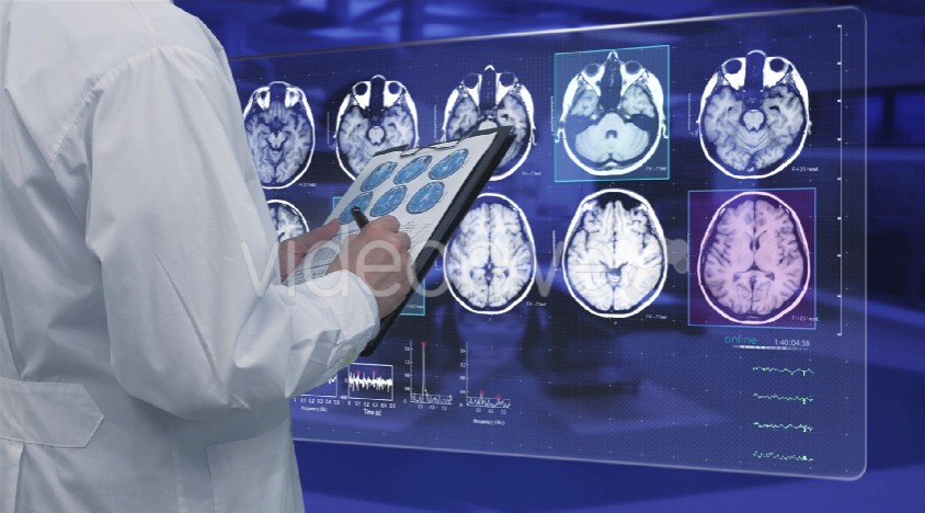 Mri and Dental Implant