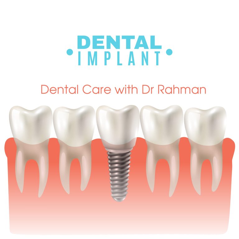 Cost of Dental Implant in Bangladesh