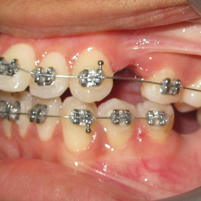 best dental brace clinic in Dhaka, Banani