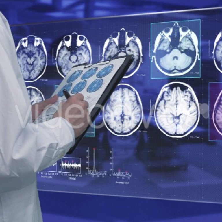 Mri and Dental Implant
