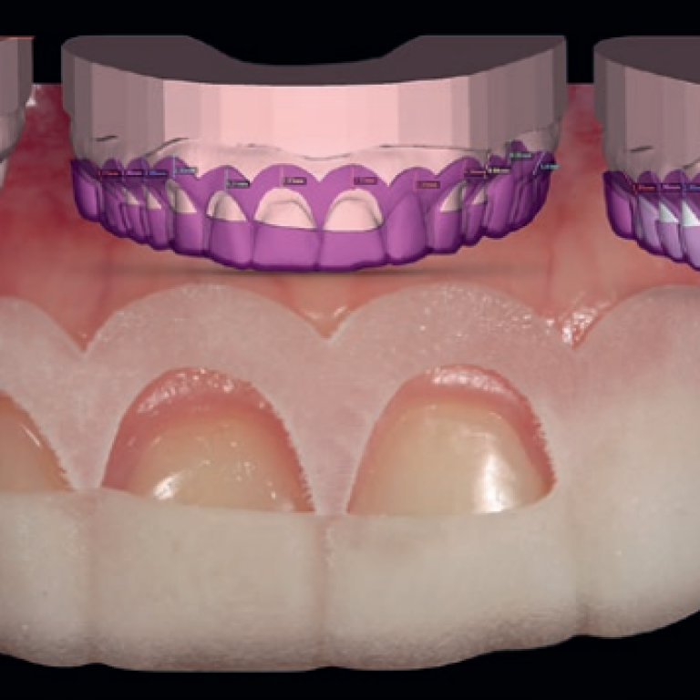 digital smile design