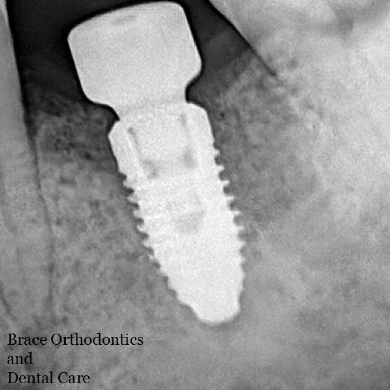 Best Dental Clinic in Dhaka